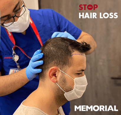 stop hair loss